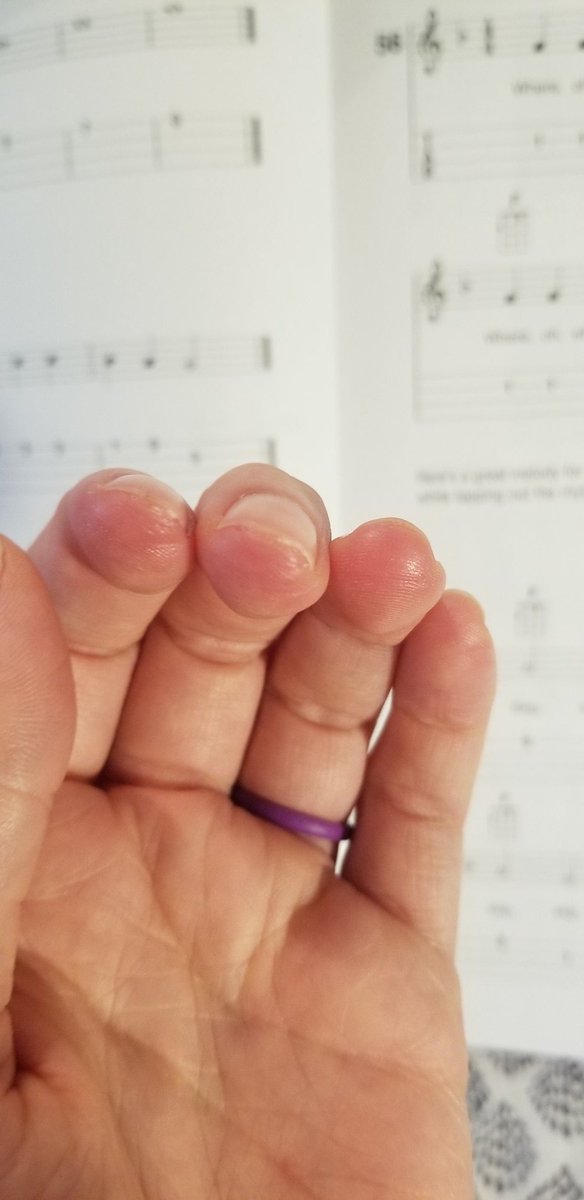 Day 14 of learning the ukulele: My fingers are starting to toughen up