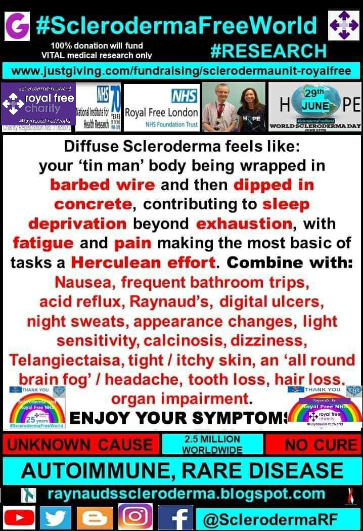 cosmicfairy444's tweet photo. @C4Dispatches @Channel4 #LongCovid similar #scleroderma https://t.co/bFMkZRWJlC #raredisesse #autoimmune #LifeChanging #systemicsclerosis #NoCure #UnknownCause #ExpertPatient 24 years hijacked, half my life #sclerodermafreeworld #RaynaudsFreeWorld #Research eternally grateful @royalfreenhs Prof Denton💖 https://t.co/L9uBOdQ6M2