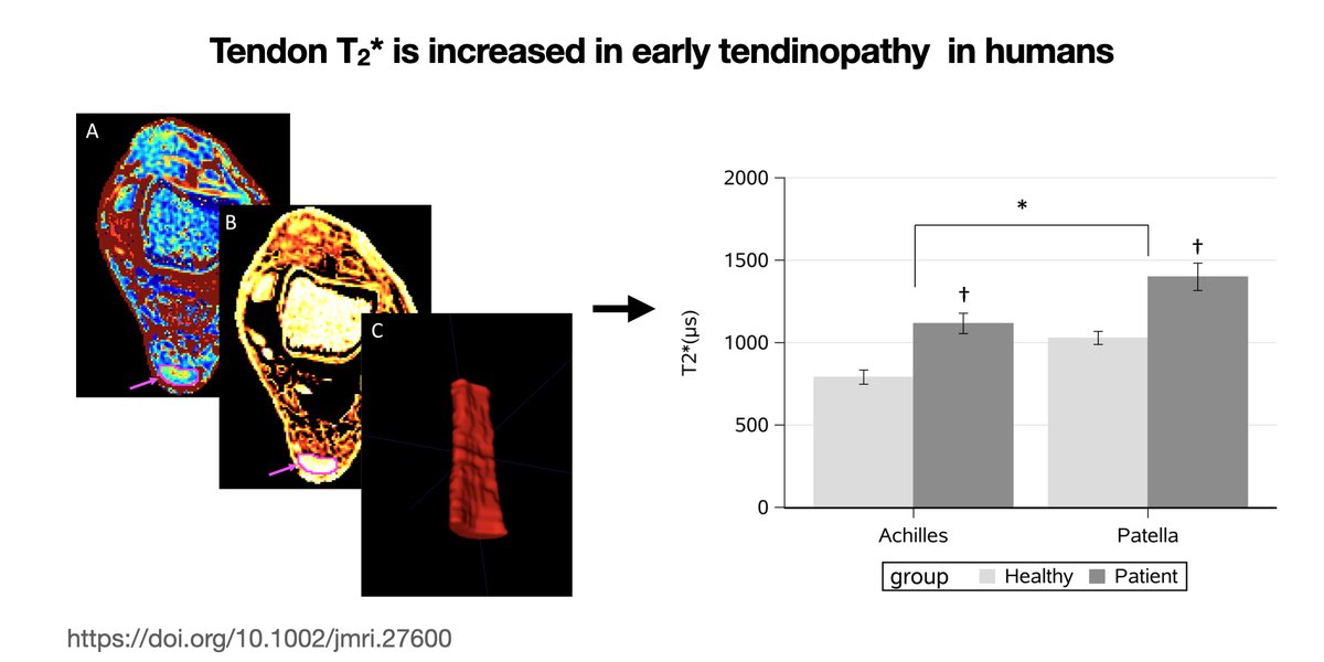 Nikolajmmc's tweet photo. Online today!

T2* MRI detects subtle changes in early phase Achilles and patellar tendinopathy. #MRI  #tendinopathy. 

https://t.co/O9G6Py47y6 https://t.co/es6oVkUDYg