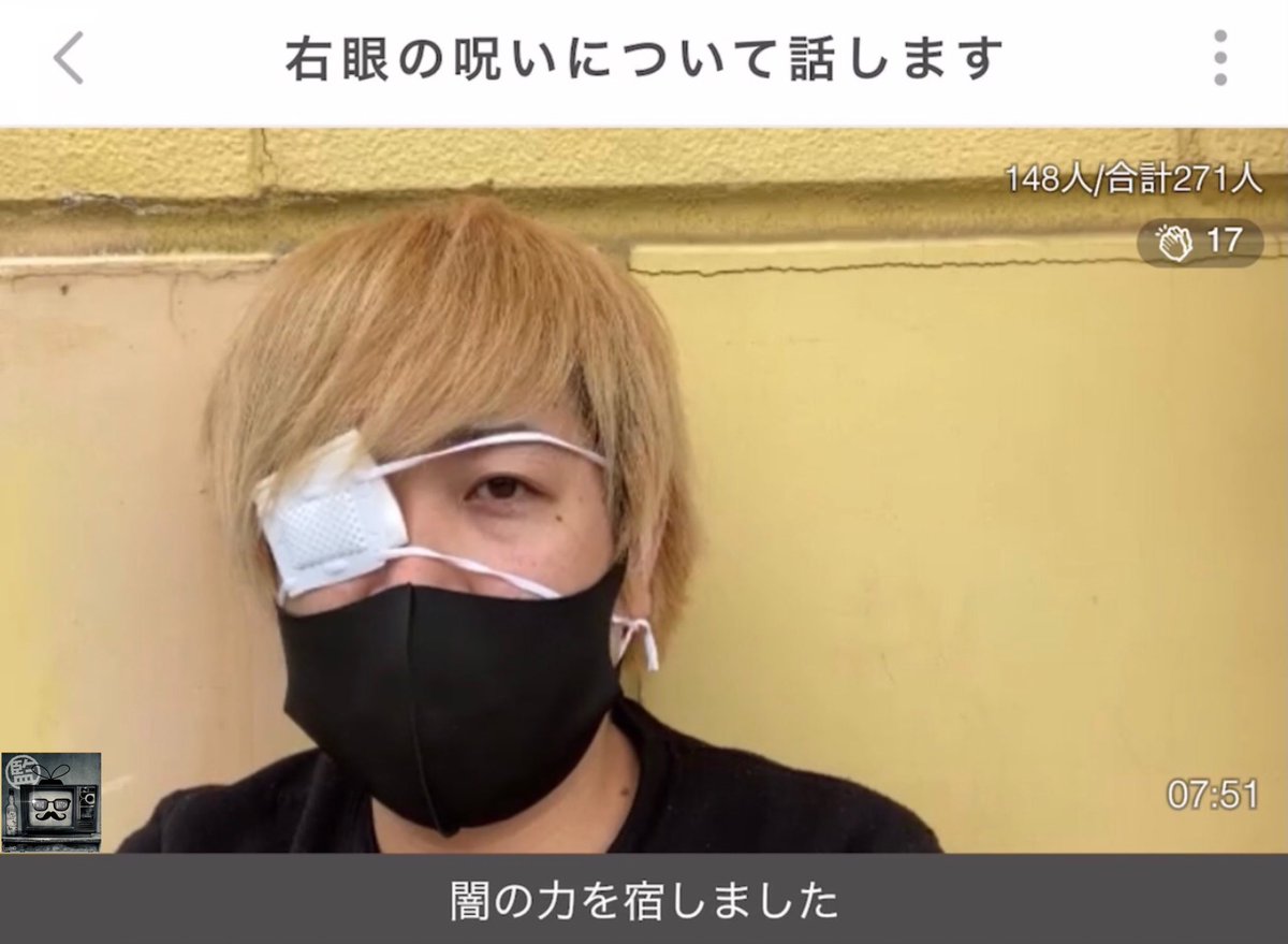 Uzivatel ふわっち監視員 Na Twitteru だっすー 右目の魔力を使いすぎた 右目が うずく 闇の力が俺を呼んでる 邪眼が発動する ではなくて 病名はですね なんと普通にものもらいでした
