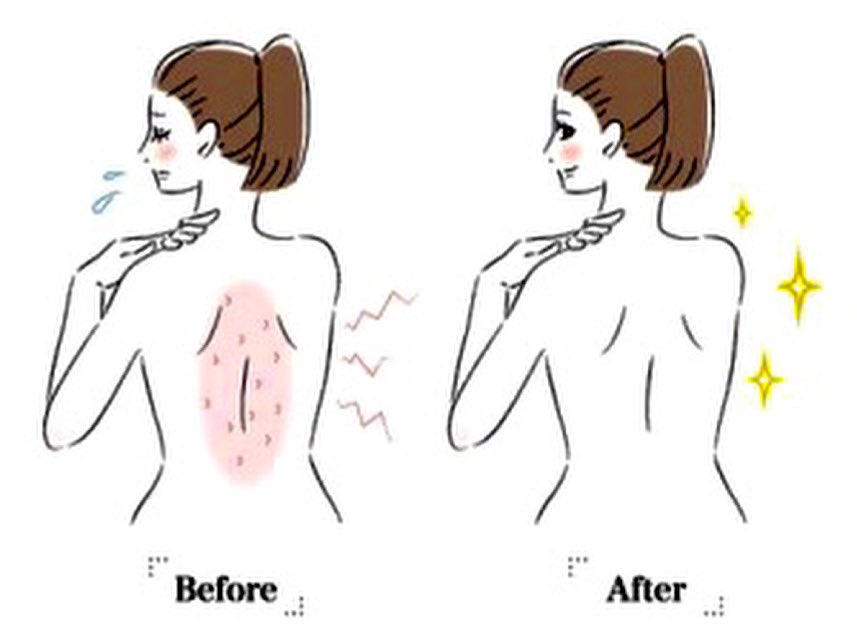 vitalwaterco's tweet image. Having skin problems?! These are problems that can come from having a #SaltChlorineGenerator ! Be Pro-Active and talk to your Resident Manager today!! #VitalWaterCompany #CleanPoolWater #heretohelp #skinproblems