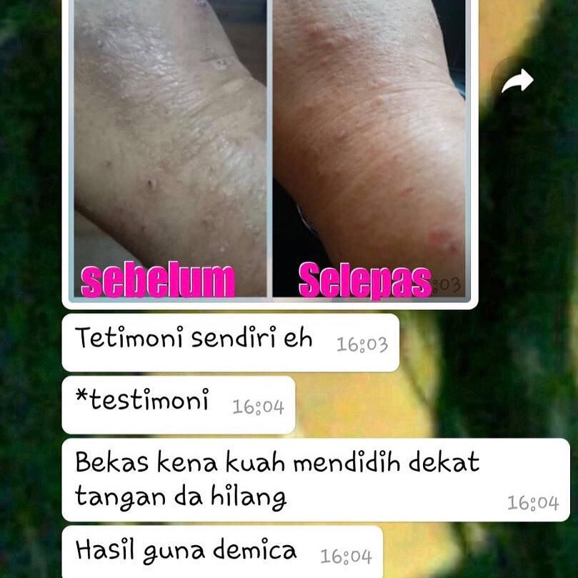 #DemicaWhiteningLotion #Demica 
#hilangparut #hilangkesanluka #Demicantik #lotionputih #lotionputihajaib #Lotionputihgebu #sayanakputih #putihcepat #putihsihat #tipsputih #nakputih #putihgebu #kulitputih #kulitcantik #kulitsihat #kulitlembut #nakcantik #tipscantik #putihberseri