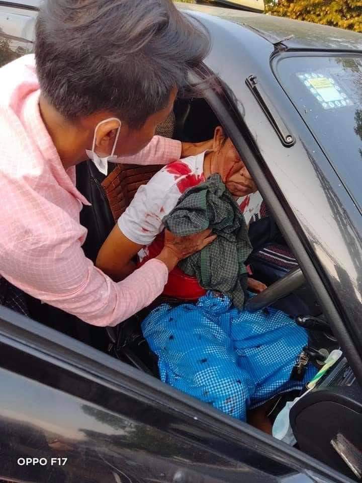 HunHsu95's tweet photo. tw // blood
A car passing by on BaYintNaung bridge was shot randomly by the military junta group. The driver of the car was seriously injured.
BLOODTHIRSTY JUNTA 
#Mar15Coup 
#WhatsHappeningInMyanmar https://t.co/ZEG9Bb63qv