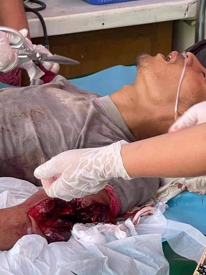 HunHsu95's tweet photo. tw // death
2 men were reporedly dead by gunshots of military junta group in MyaYeeNandar, Mandalay.

BLOODTHIRSTY JUNTA
#WhatsHappeningInMyanmar #Mar15Coup https://t.co/EBMMfDEFO5