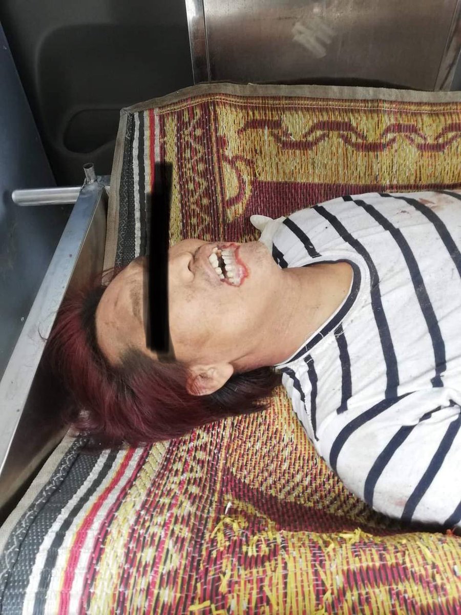 Christina1Feb21's tweet photo. tw // blood // sensitive content
Police station contacted charity org to send the body to Thingyankyun San Pya hospital on 14 Mar. As per witness, the body has gunshot on his leg and no lower lip at all 
NEWS SUPPRESSION
#WhatsHappeningInMyanmar 
#Mar16Coup https://t.co/6UHU1v00yU