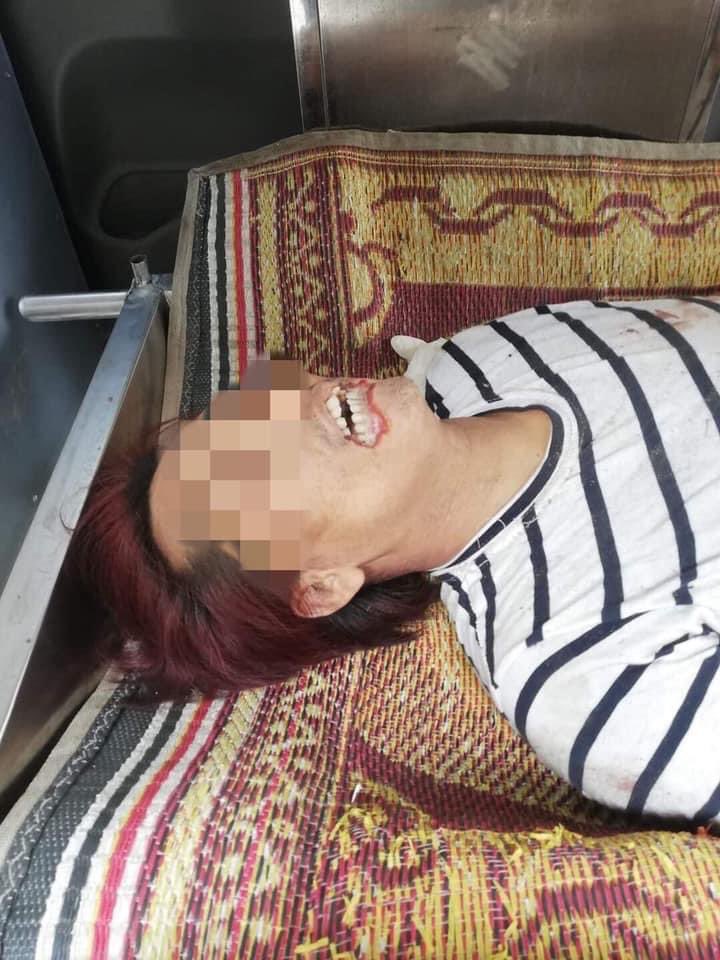Tw // death
A body was sent to Thingangyun SanPya Hospital at 8 am. The police called the ambulance to pick up the dead body. The patient had a gunshot wound in the leg. His lower lip was also seen to be cut. NEW SUPPRESSION #WhatsHappeningInMyanmar #Mar16Coup