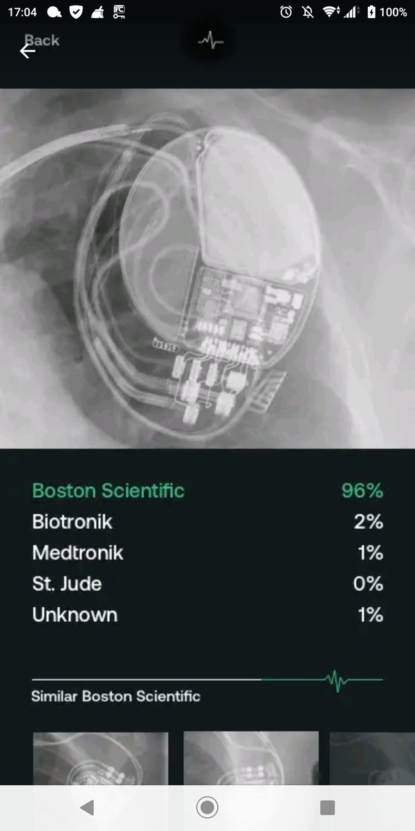 boc66will's tweet image. 胸部レントゲン写真のペースメーカー画像を写真取るだけで各社メーカーを識別出来るというアプリ。

未だに合っていたことはない笑
※画像はサンプルなので個人情報は含まれません