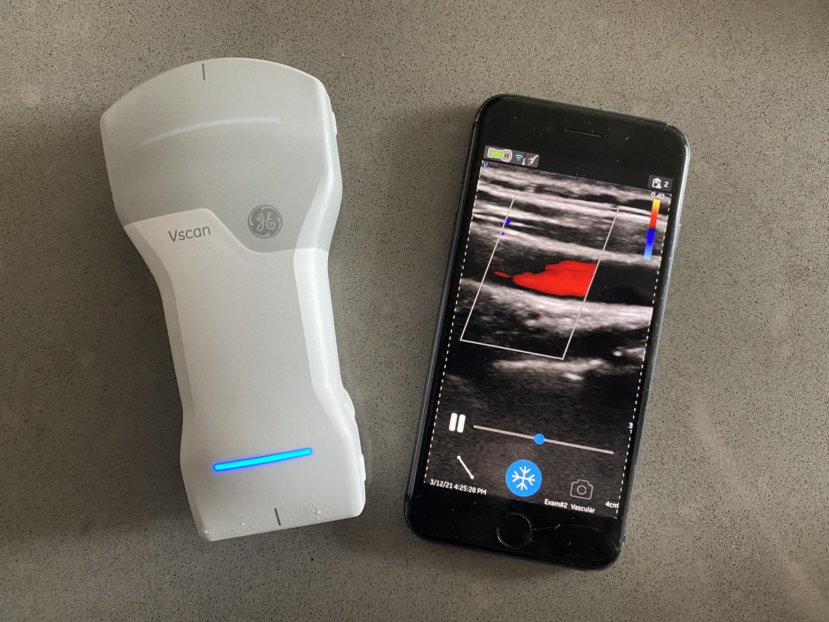 GinaWithGE's tweet photo. Hello Twitter, my name is Vscan Air and I’m the NEW wireless, handheld ultrasound 🤩 https://t.co/VOW8sfKOWr