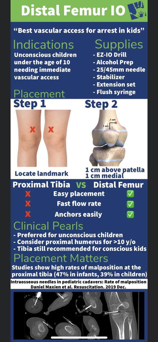 Handtevy's tweet photo. It's time to abandon the proximal tibial IO in pediatric cardiac arrest.

The distal femur has many advantages over the proximal tibia, including faster flow rates, and easier and more secure placement. @HandtevyMD 

Time for an infographic👇 https://t.co/vZUGgx4nhC