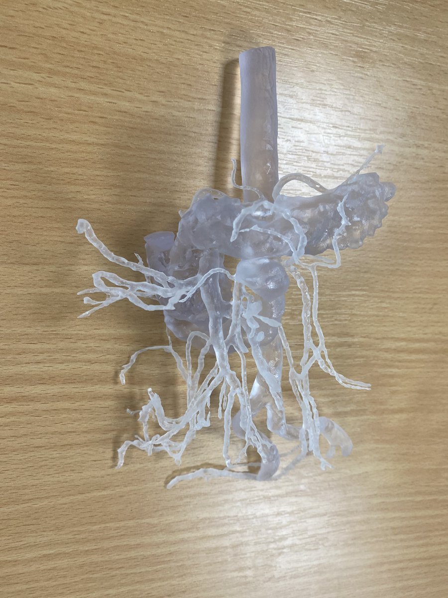 A mesenteric angiogram model printed on our in house 3D Technology Ltd MultiJet clear polymer printer for Ronan Cahill in the Mater Hospital.

#3dprinting #surgicalplanning #polymer #anatomy

MedScan3D Jacqui O' Connor