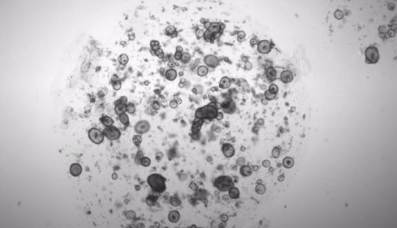 IFLScience's tweet photo. Scientists Created Human Organoids Whose Purpose Is Only To Cry
https://t.co/H9pDtADDqw https://t.co/GPHb59u2yZ