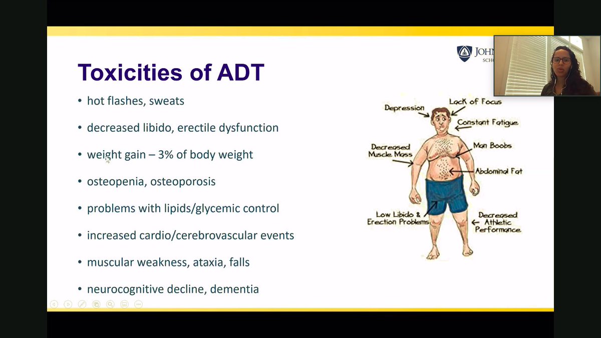 Great talk about prostate cancer for internists by <a href="/CathyHandy/">Cathy Handy Marshall, MD MPH</a>