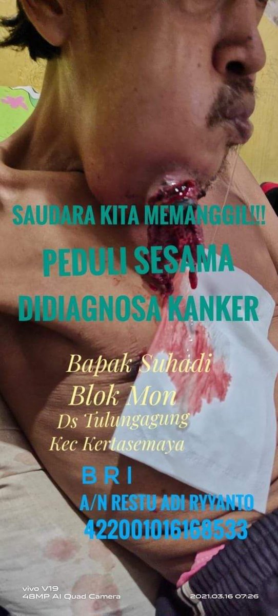 IkaTuslikhah's tweet photo. Peduli sesama, semoga dimudahkan proses pengobatan untuk beliau di RS. Hasan Sadikin @kotaindramayu @dinsosjabar @ridwankamil https://t.co/GBMybqC3wv