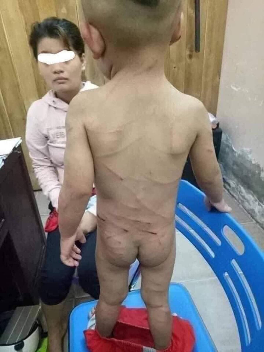 BOBOZAW77's tweet photo. On 16.3.2021, Military terrorists brutally beat 2 yrs old son when they didn’t find his father who protested at #HlaingTharYar #CrimesAgainstHumanity #WhatsHapppeningInMyanmar #ChildAbuse https://t.co/80SdqQTxy1