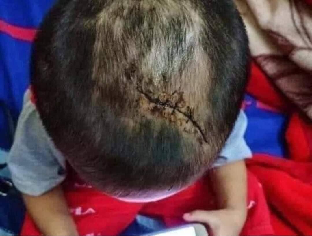 BOBOZAW77's tweet photo. On 16.3.2021, Military terrorists brutally beat 2 yrs old son when they didn’t find his father who protested at #HlaingTharYar #CrimesAgainstHumanity #WhatsHapppeningInMyanmar #ChildAbuse https://t.co/80SdqQTxy1