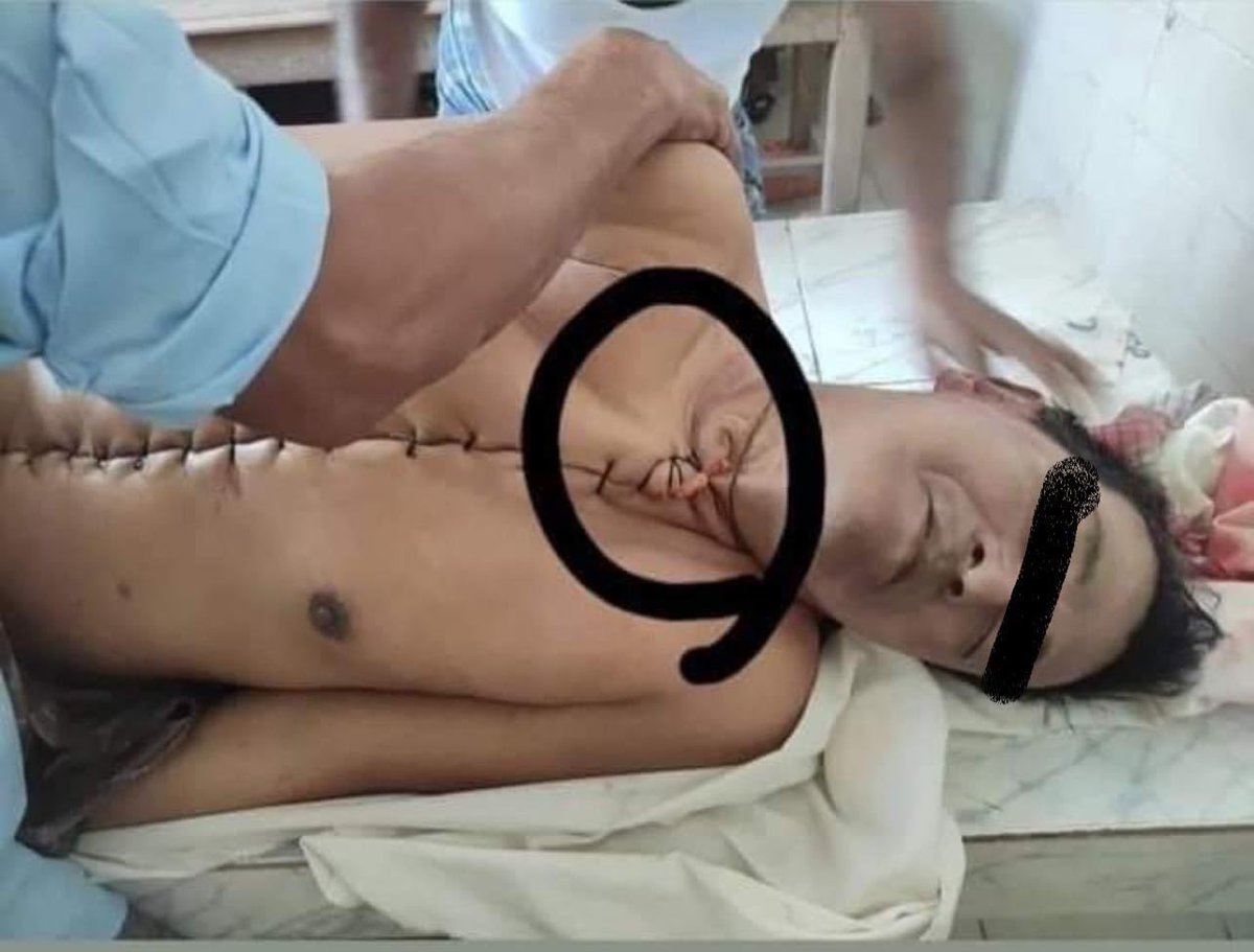 khaing_phuu's tweet photo. Many arrested victims are still missing or some were sent back dead with Postmortem carried out. I wonder what organs were being removed from the deceased. Is there any link between the coup regime and China? Are they doing organ transport trade? #WhatsHappeningInMyanmar https://t.co/ESGP0izoO1