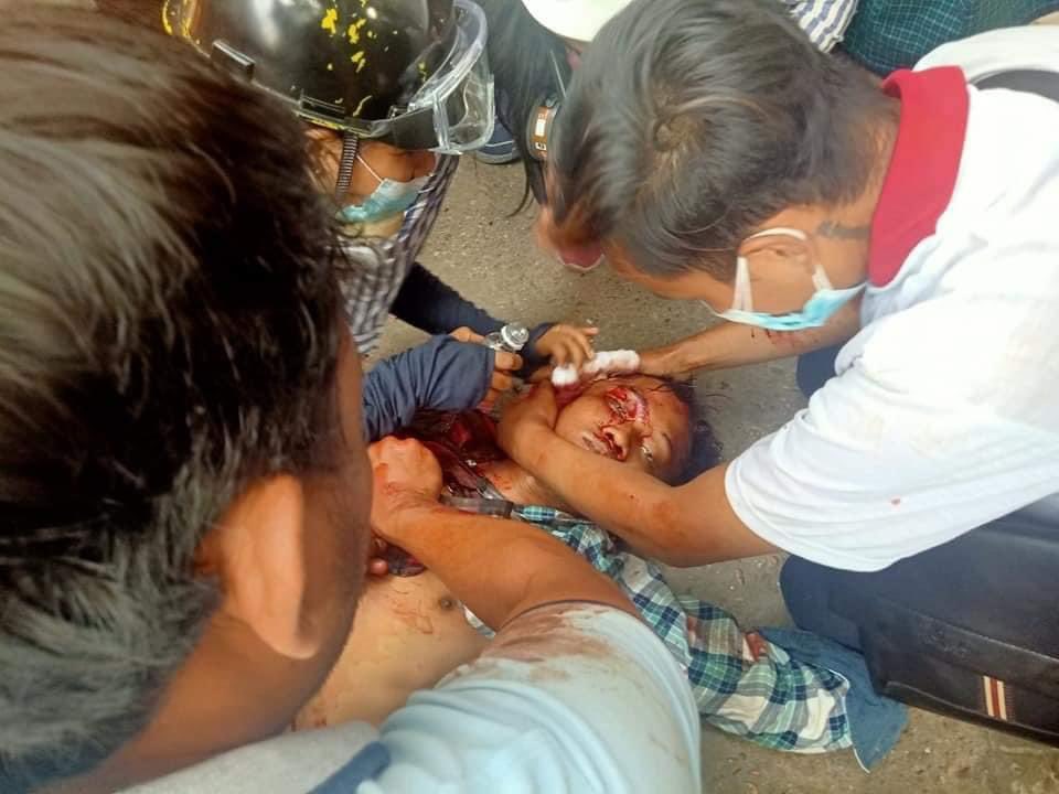 AlexanderAung19's tweet photo. Breaking News:  Yangon,  March 17

 A man was shot dead in the head on March 17 at 3:30 pm at Hlaing Township in Rangoon.#AgainstMyanmarMilitaryCoup #WhatsHapppeningInMyanmar https://t.co/cTVGkUiBRw