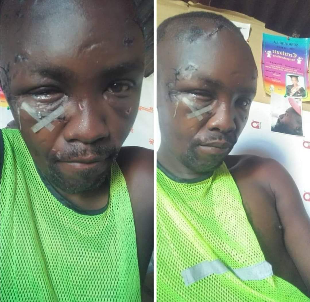 AviweN_'s tweet photo. This man risked his life to save a woman who was in the hands of a rapist. He sustained these injuries, but managed to save the woman from a life long sorrow of being a victim. https://t.co/IKPZ04SyRE