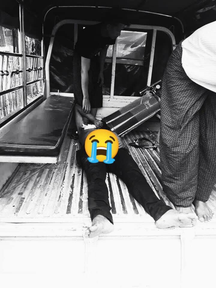 As police undertake a major break down in Kalay, barricades were burnt n they also opened fire on peaceful protesters n killed one man. Then army vehicles blocked roads, making difficult to send victim hospital in time.
RESTORE MOBILE DATA
#Mar17Coup
#WhatsHappeningInMyanmar