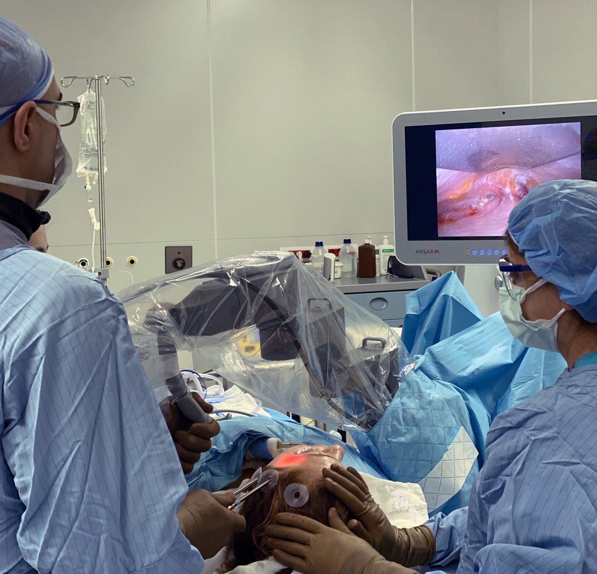 Do you know What is The Difference Between the Traditional Facelift and  the Endoscopic Facelift? 
visit our website to know more😀
avsarclinic.com/endoscopic-upp…
#endoscopicsurgery #endoscopic #upperfacelift
#eyebrowslift #yakupavsar #avsar #yakup #plasticsurgeon #aesthetic #surgeon