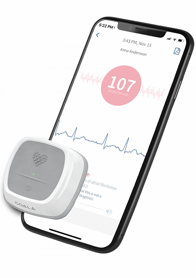 Palpitations, particularly common in women, are generally considered benign symptoms rarely caused by clinically important arrhythmias. Nevertheless, palpitations may cause anxiety, depression, and decreased health-related quality of life. Direct feedback by Coala was beneficial.