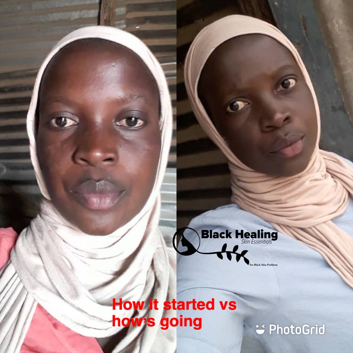 With Black Healing, there is ALWAYS healing!!! #NaturalBeauty