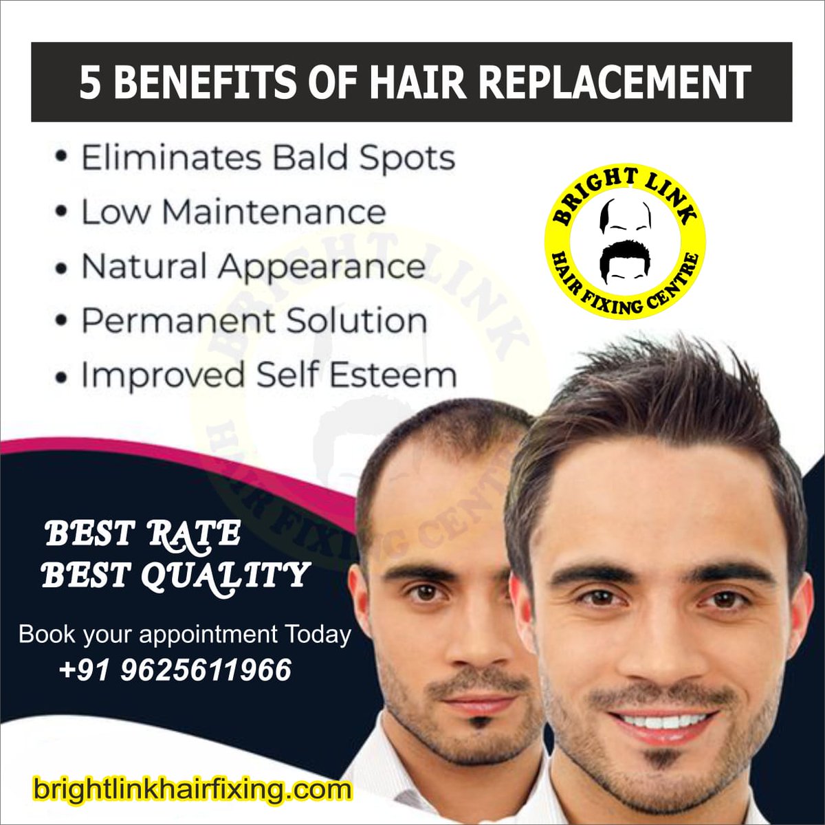 تويتر \ Bright Link Hair fixing Centre (FixingCentre@) تويتر \ Bright Link Hair fixing Centre (FixingCentre@)