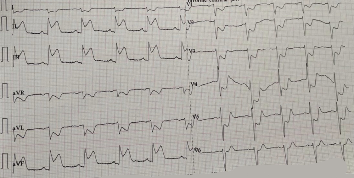 Pt: “Doctor, am I going to be ok? Will this PCI work? Please tell my family I love them.”
Me: “of course you’re going to make it and be able to tell them yourself.”
He didn’t…
#ToughJob