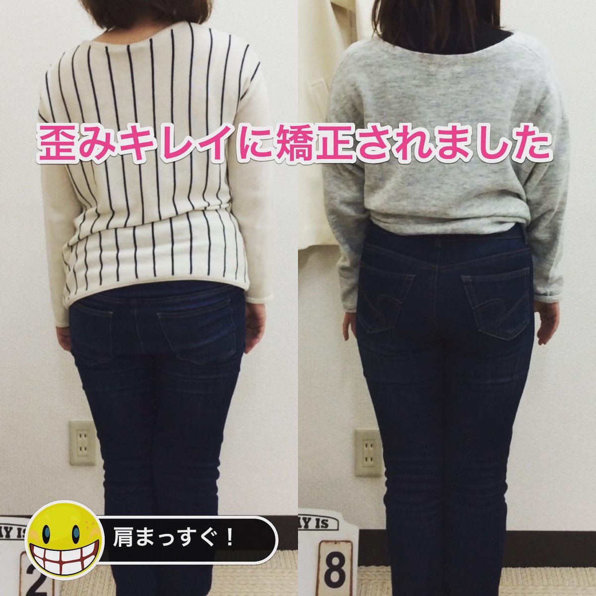 産後骨盤矯正専門 やまだ整体院 V Twitter 下半身から腰の高さまでは真っ直ぐなのに 肩だけが曲がった なんて事はありません 下から全部歪んでます 結果的に目に見えやすい肩の歪みが目立つ それだけの話です 逆に肩が真っ直ぐ という事は歪みが全て整った 産後骨盤矯正専門 やまだ整体院 V Twitter 下半身から腰の高さまでは真っ直ぐなのに 肩だけが曲がった なんて事はありません 下から全部歪んでます 結果的に目に見えやすい肩の歪みが目立つ それだけの話です 逆に肩が真っ直ぐ という事は歪みが全て整った