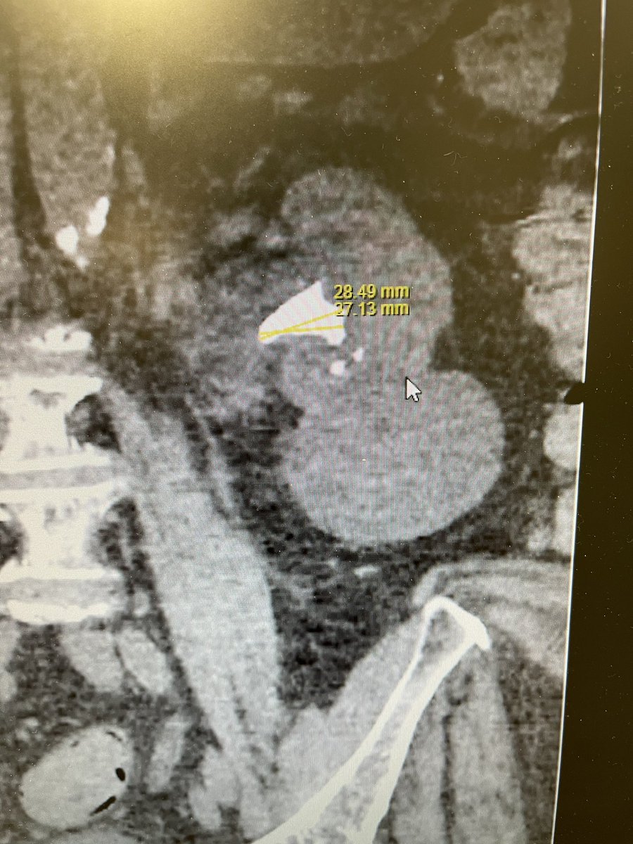 Azi Samsudin tweet media