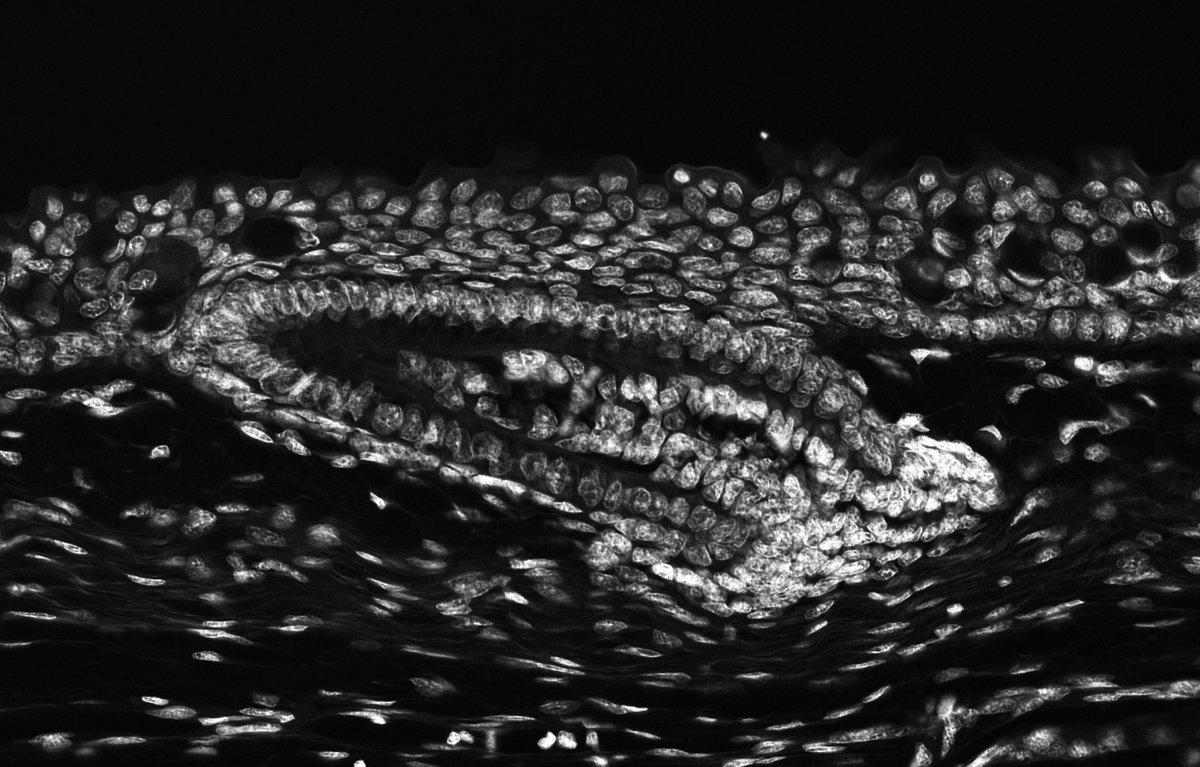 garethjfraser's tweet photo. Have you ever seen a developing #shark skin denticle (aka skin tooth)? This histological section shows the cellular detail of a denticle still forming under the surface of the embryonic catshark (Scyliorhinus canicula) epidermis. #skinteeth #denticles #devbiol #evodevo 🦈🦷🔬 https://t.co/Envf0KEVuN