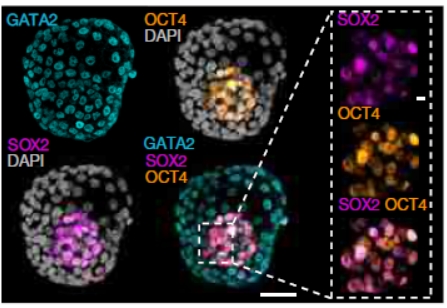 humanblastoid's tweet photo. This week, a major breakthrough for human developmental biology
Today, two papers on human stem cell-derived embryo models (#HumanBlastoid), are published in Nature
Last week, two other manuscripts were posted on bioRxiv

This is a game changer for the field
A thread
1/8 https://t.co/G2S6iZHIaV
