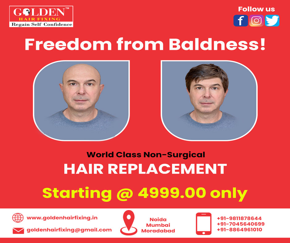 Golden Hair Fixing (@GoldenFixing) / Twitter Golden Hair Fixing (@GoldenFixing) / Twitter