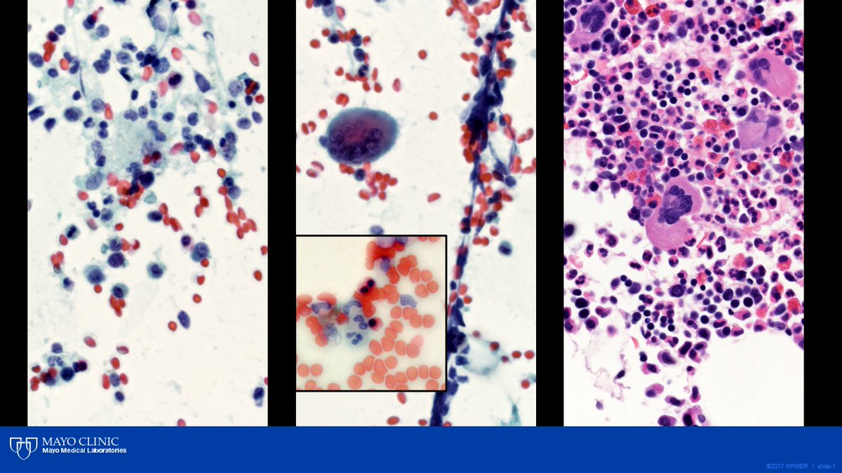 Gary L. Keeney, M.D. tweet media