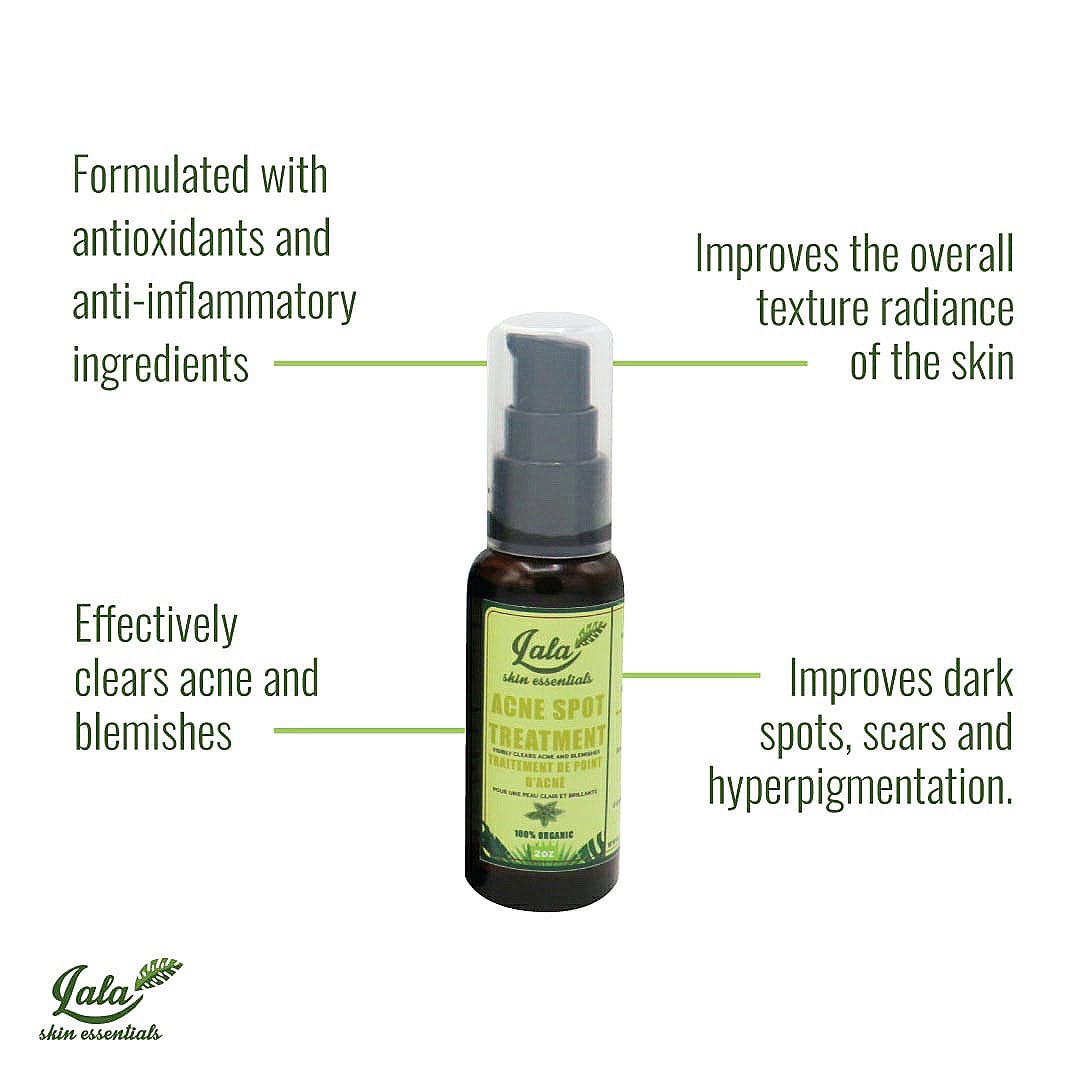 Lalaskin_africa's tweet photo. Choose the best ACNE fighter🤩! The Lala Acne Spot Treatment permanently remove and prevent acne, blemishes ,dark spots, pimples,sunburns and more! 

Price- 5,000
#2MANDS #Kwara #Suarez #archchallenge #CHEATM #dogecoin #OPPOxLaycon #TachaXJumia https://t.co/t8IXbdrNKi