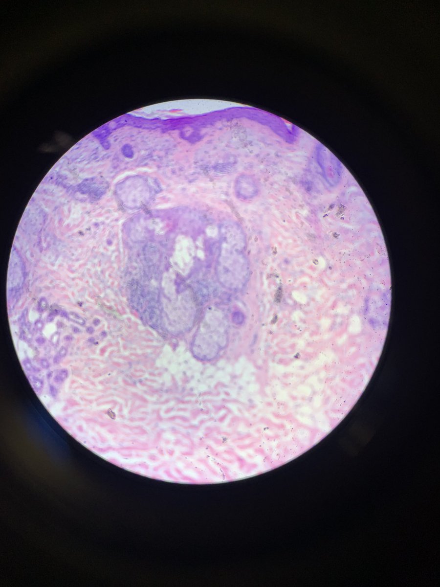 #106Week8MVS21 <a href="/mckennavininski/">McKenna Vininski (she/her)</a> the cancer basal cell was the most interesting to me from lab today! Is it wrong to say it’s kinda beautiful?