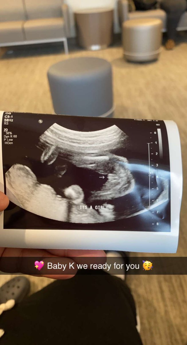 _Marshall96's tweet image. Ahhh bitter sweet moment . 💖 #Aug3rd ♌️