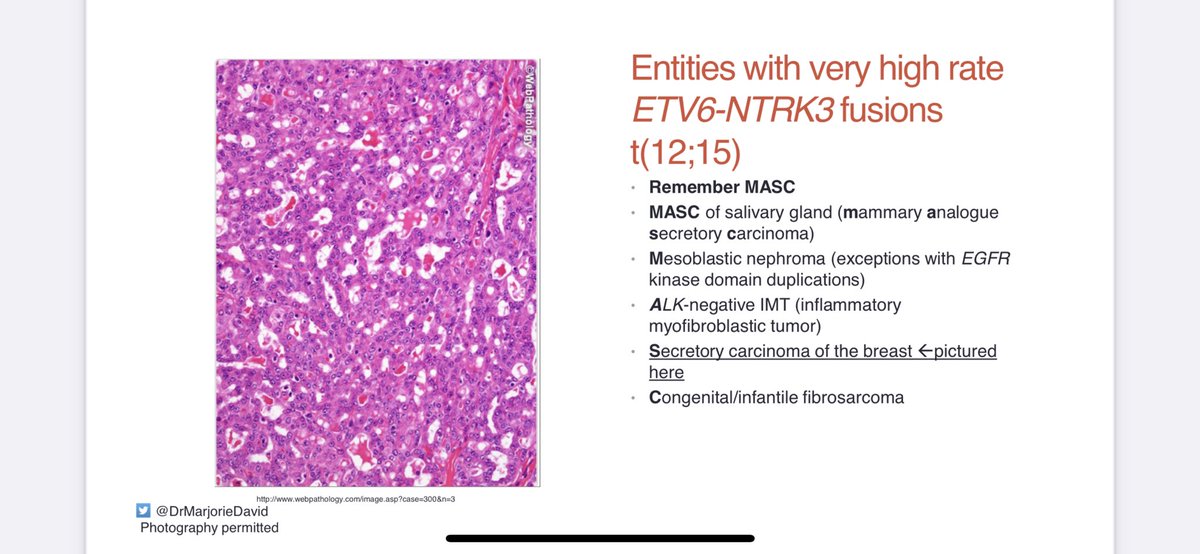 Thought I’d share a mnemonic I made for tumors with a high rate of ETV6-NTRK3 fusion. Memorize “MASC” and get 5 tumors for the price of 1 fusion for #pathboards. From my recent didactic with @UTHealthSA_Path @ghezavatipath @jacobritter2 @alkhateb_rahaf @mennaewais