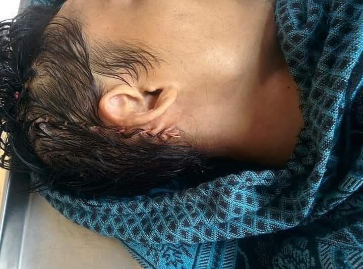 sounggrace04's tweet photo. Ko Aung Phyo Htet got shot at March 14 and was arrested by junta.  Today, we just got back his dead body only and this is how they treated him. 
@EUMyanmar @TostevinM @BBCWorld @freya_cole  @RapporteurUn @KenRoth @poppymcp @SabatucciEU 
#WhatsHappeningInMyanmar 
#Mar16Coup https://t.co/zSE52rD8nF