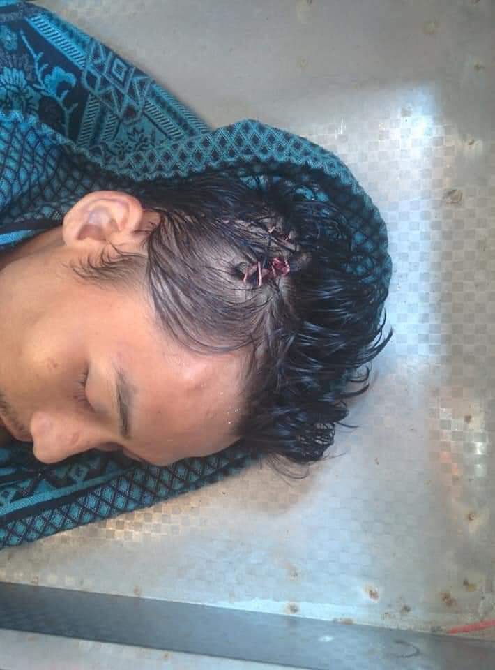 sounggrace04's tweet photo. Ko Aung Phyo Htet got shot at March 14 and was arrested by junta.  Today, we just got back his dead body only and this is how they treated him. 
@EUMyanmar @TostevinM @BBCWorld @freya_cole  @RapporteurUn @KenRoth @poppymcp @SabatucciEU 
#WhatsHappeningInMyanmar 
#Mar16Coup https://t.co/zSE52rD8nF