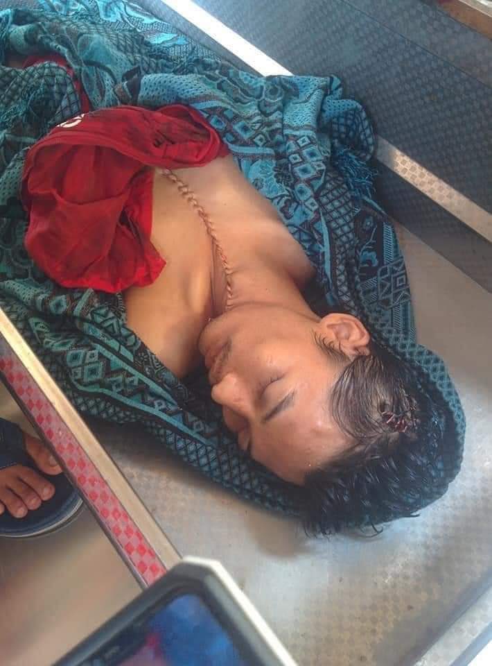 sounggrace04's tweet photo. Ko Aung Phyo Htet got shot at March 14 and was arrested by junta.  Today, we just got back his dead body only and this is how they treated him. 
@EUMyanmar @TostevinM @BBCWorld @freya_cole  @RapporteurUn @KenRoth @poppymcp @SabatucciEU 
#WhatsHappeningInMyanmar 
#Mar16Coup https://t.co/zSE52rD8nF