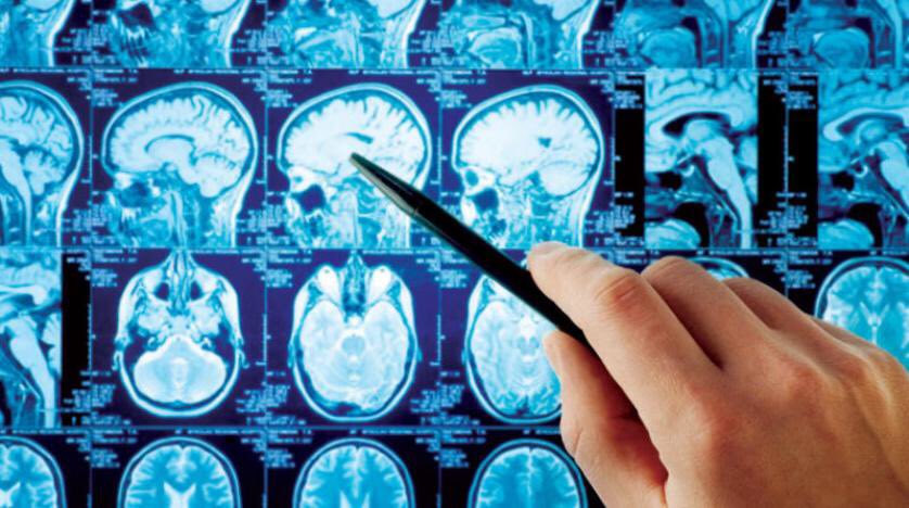 Cam_Medicine's tweet photo. استشارات طبية || جراحة ورم المخيخ للطفل || د. حسن صندقجي
#Brain_surgery #Children
https://t.co/yJtbUVvLt8 https://t.co/uaCOQcdmdG
