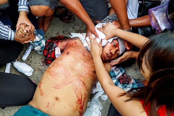 Protesters try to give first aid to fellow protester Phay Thein Kyaw after he was shot in the head during a crackdown on an anti-coup protest at Hlaing Township in Yangon yesterday #WhatsHappeningInMyanmar <a href="/reuterspictures/">Reuters Pictures</a>