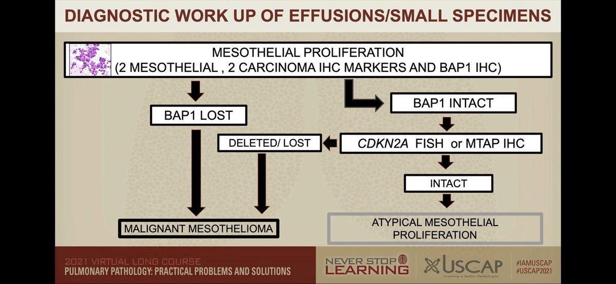 diagnosis malignant pleural mesothelioma