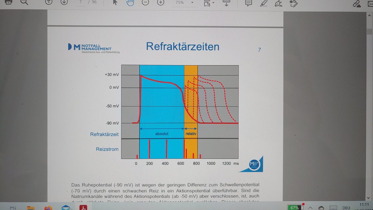 #EKG mit <a href="/MegaMedGbr/">MegaMed GbR</a>