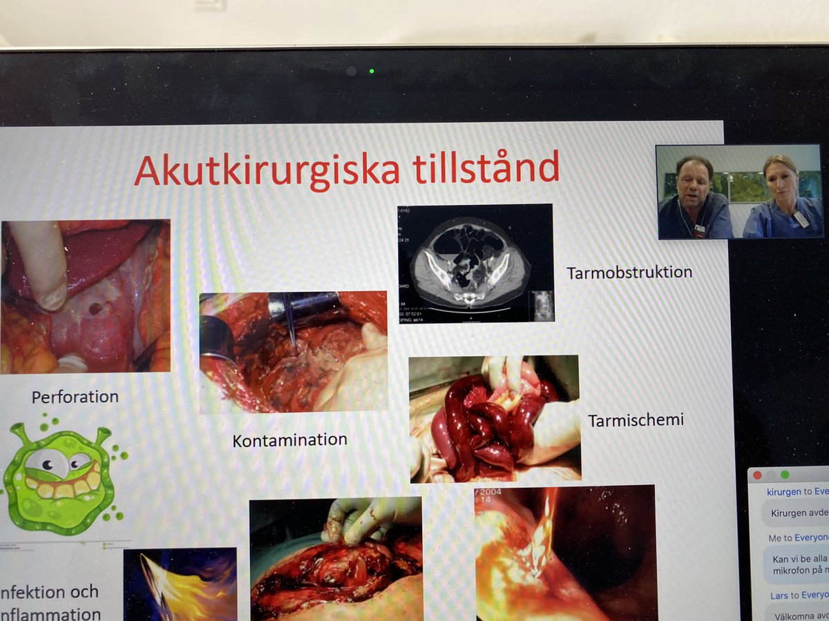 Superb webinar by SwERAS the Swedish ERAS Society on the emergency laparotomy guidelines