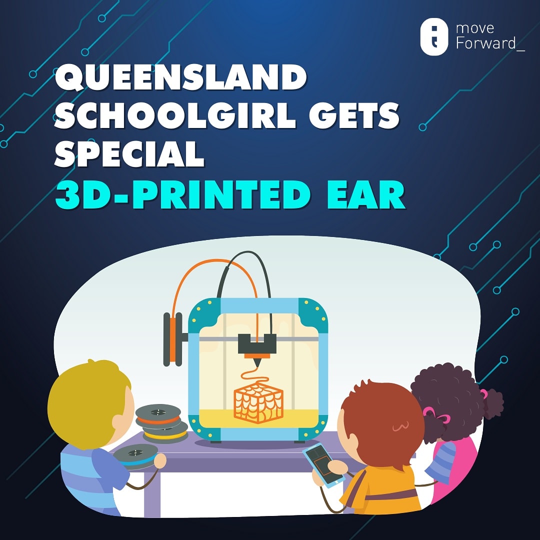 moveForward_100's tweet photo. A 10-year old girl, residing in Queensland is the first person to undergo a patient-matched 3D-printed ear reconstruction in groundbreaking surgery.
#newscoding #codingnews #coding #coder #technology #3Dprintedear #tech #codingforkids #moveforward #3Dprinter #queensland #surgery https://t.co/5chNXXKGUq