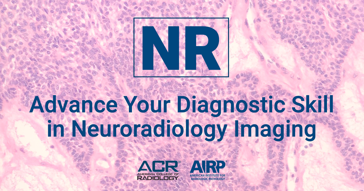 In search of a comprehensive review of #neurorad that includes spine, head &amp; neck imaging? 👀 Look no further than our Neuroradiology Categorical Course. Next session begins March 29 📅 👉 bit.ly/38LjjYc