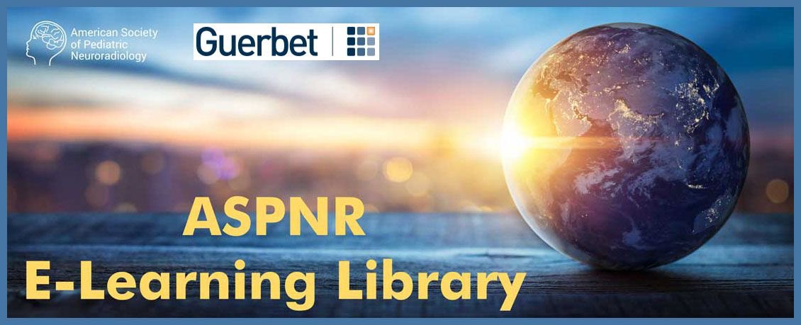 American Society of Pediatric Neuroradiology (@the_aspnr) on Twitter photo ASPNR NEW E-Learning Library is now LIVE!
Exclusive to members. Join now and enjoy all of the amazing content.
aspnr.org/e-learning-vid…
ON-DEMAND ONLINE VIDEO LECTURES
Thank to <a href="/GuerbetGroup/">Guerbet Group</a> for the support ASPNR NEW E-Learning Library is now LIVE!
Exclusive to members. Join now and enjoy all of the amazing content.
aspnr.org/e-learning-vid…
ON-DEMAND ONLINE VIDEO LECTURES
Thank to <a href="/GuerbetGroup/">Guerbet Group</a> for the support