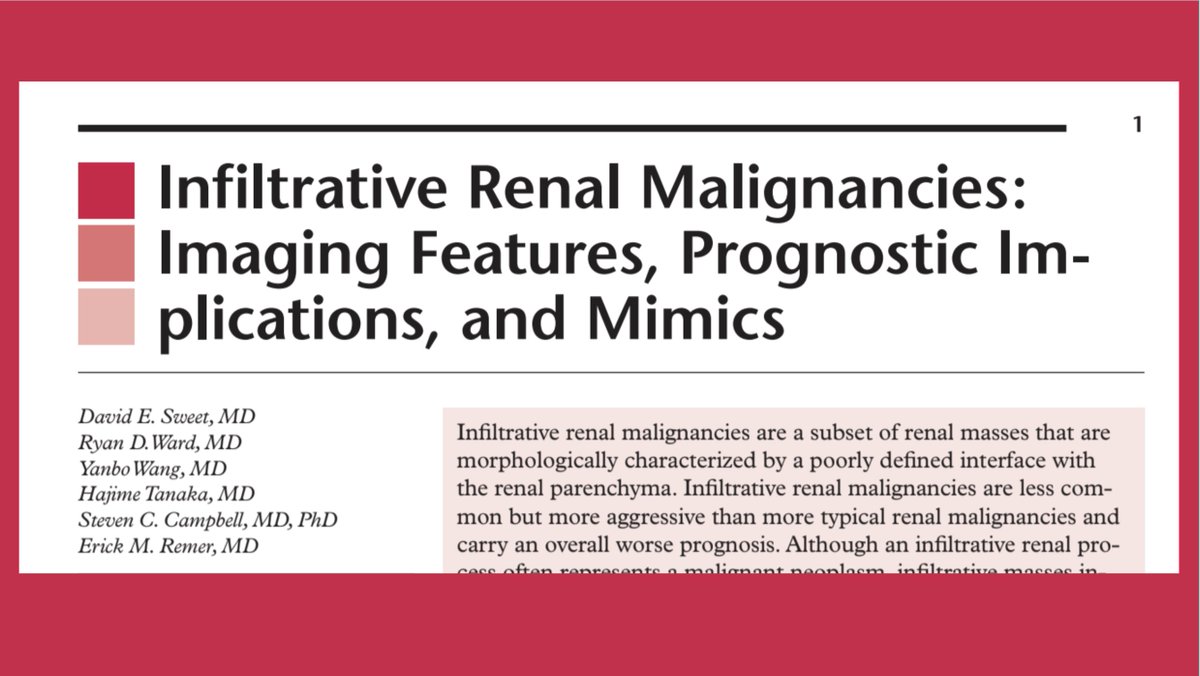Ashkan A. Malayeri MD (@aamalayeri) on Twitter photo If you get to scratch your head at least once a month looking at an infiltrating mass of the kidney, then this excellent @radiographics article by <a href="/DavidESweet1/">David Sweet</a> et al. is for you!
shorturl.at/uwEQ9
#RGphx If you get to scratch your head at least once a month looking at an infiltrating mass of the kidney, then this excellent @radiographics article by <a href="/DavidESweet1/">David Sweet</a> et al. is for you!
shorturl.at/uwEQ9
#RGphx